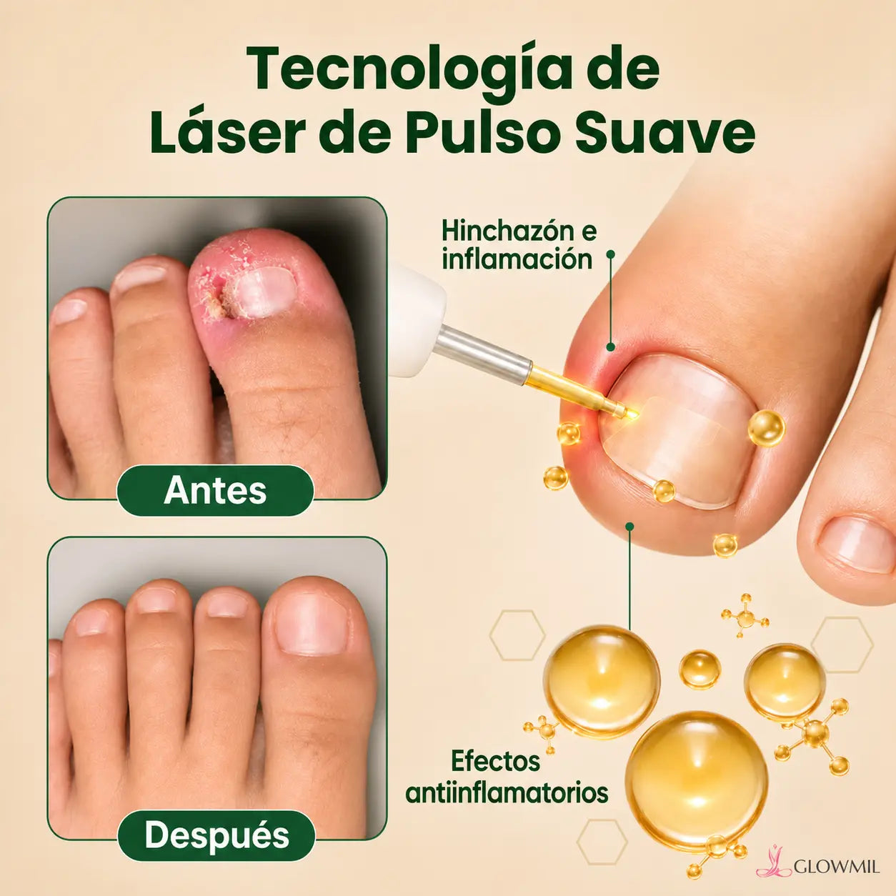 7Days® | Uñas Libres de Hongos en 7 Días - Tratamiento Natural y Efectivo🌿