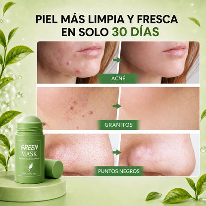 Glow Detox Mask® | Mascarilla en Barra Anti-Poros & Anti-Hinchazón🌿