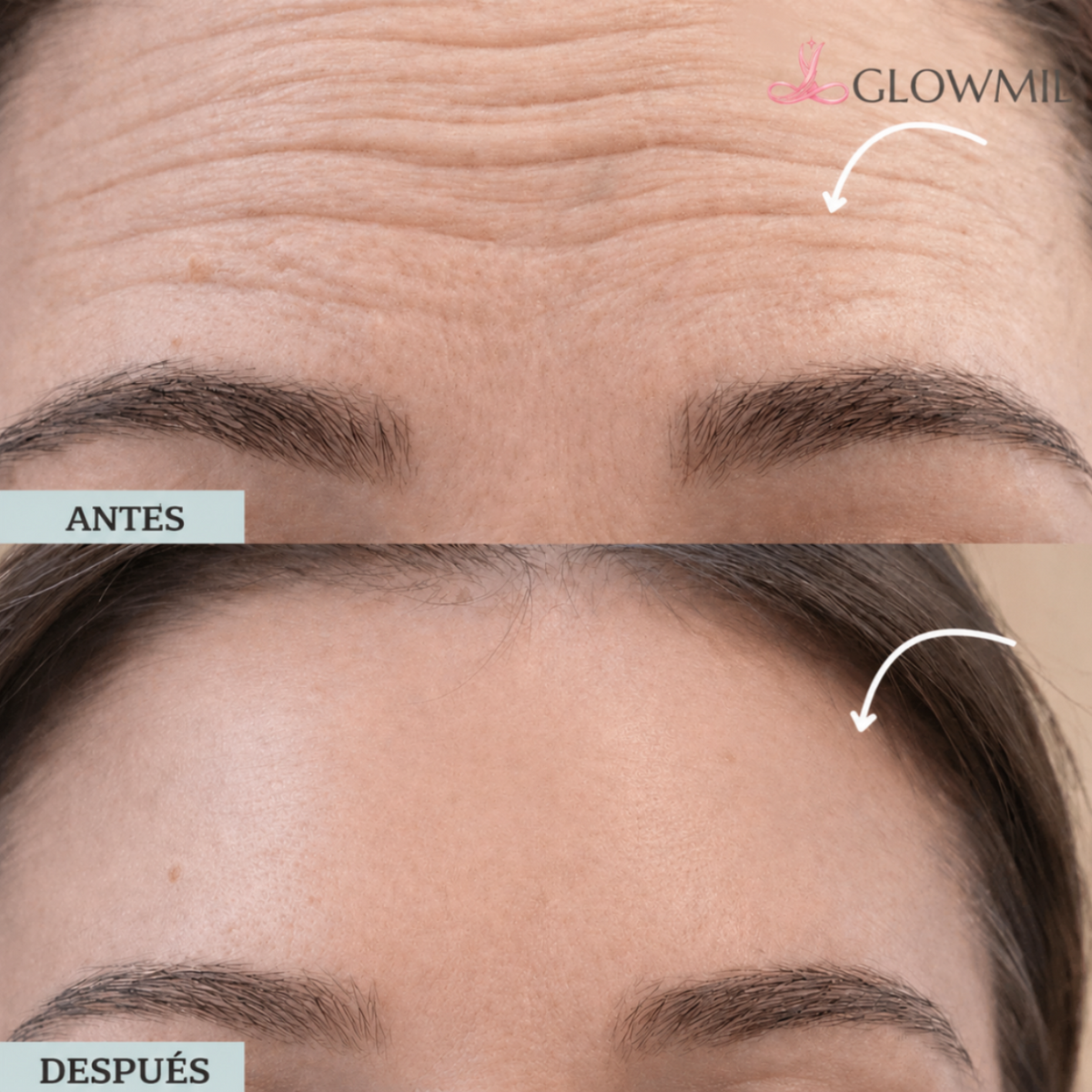 GlowBrush™ | Tu rostro sin hinchazón. Tú misma.